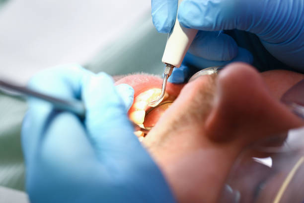 Best Pediatric Emergency Dentist in Rahway, NJ